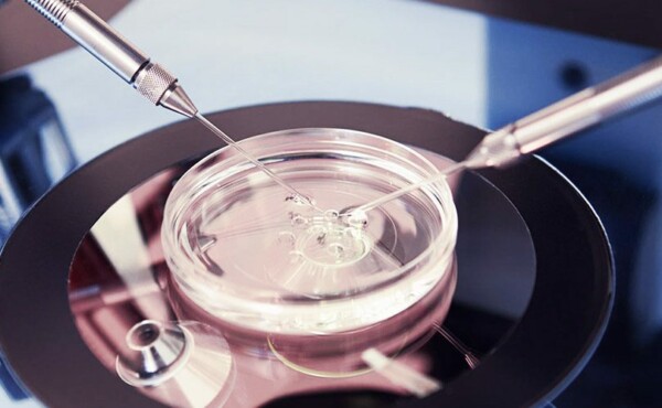 Fertilização In Vitro