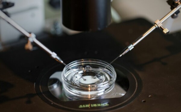 Fertilização in Vitro (FIV)